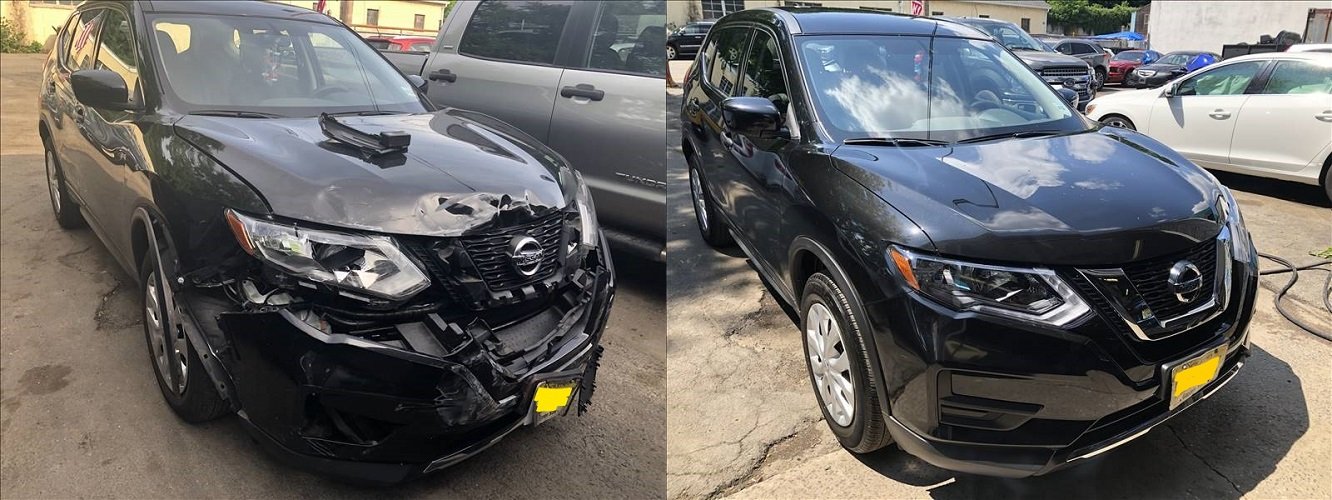 Dent removal